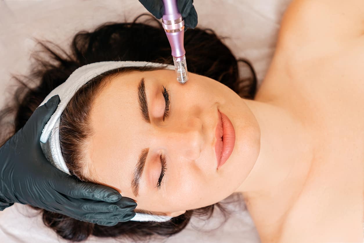 A Clear Difference: The Benefits of Potenza RF Microneedling