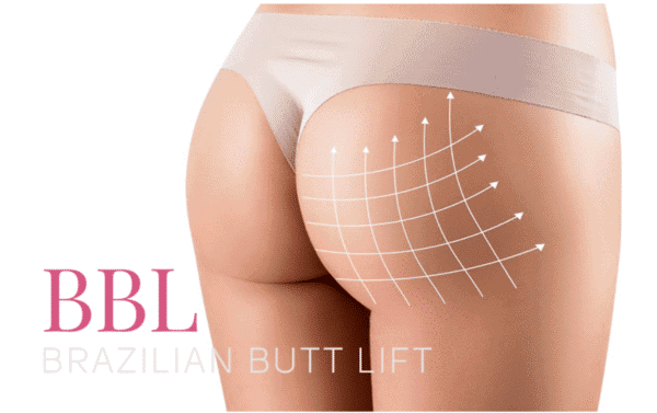 Give your bottom a boost with a Brazilian Butt Lift